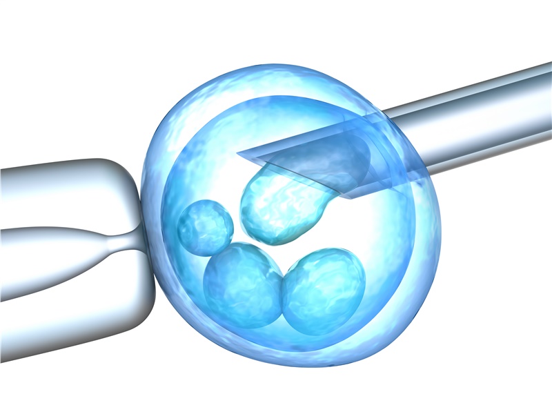 Tüp Bebekte Kaç Embriyo Transfer edelim?